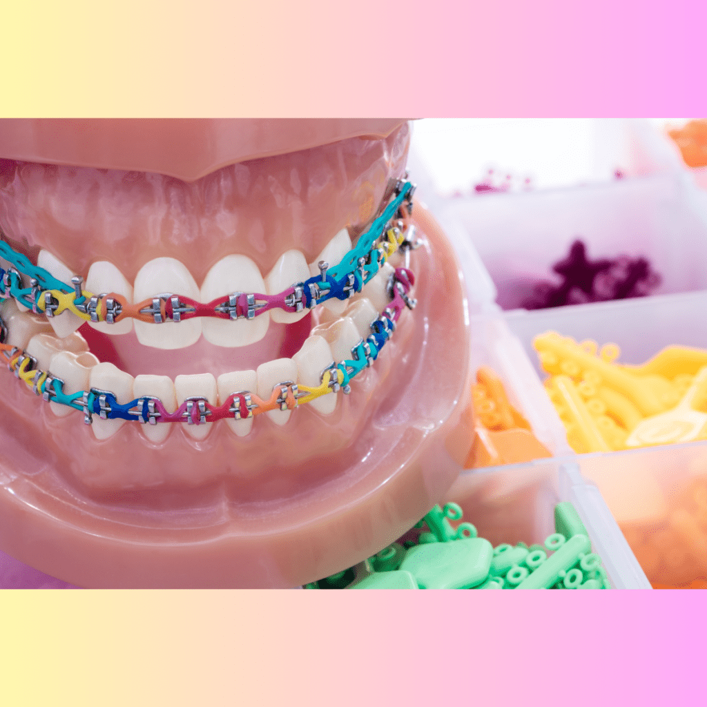 โปรโมชั่น จัดฟัน ทันตกรรมจัดฟัน คลินิกทันตกรรมพีเอสเค PSK Dental Center จัดฟันเหล็ก จัดฟันติดแน่น จัดฟันใส invisalign