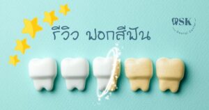รีวิวฟอกสีฟัน - ผลลัพธ์ที่มีจากการฟอกสีฟัน และคำแนะนำเกี่ยวกับวิธีการฟอกสีฟันให้ขาวสว่าง