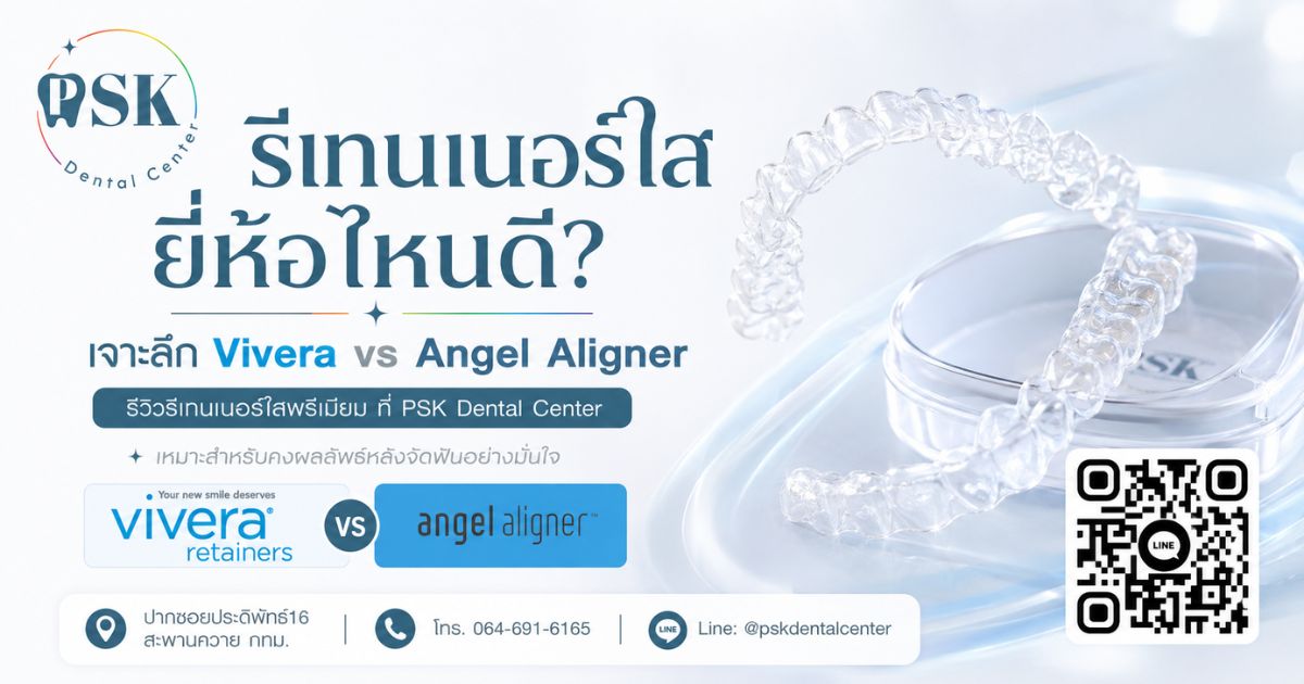 รีเทนเนอร์ใส ยี่ห้อไหนดี? รีวิวรีเทนเนอร์ใสพรีเมียม Vivera & Angel ...