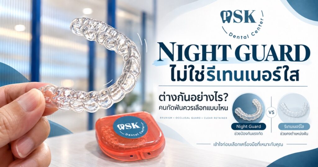 Night Guard เฝือกสบฟันเปรียบเทียบกับรีเทนเนอร์ใส โดยคลินิกทันตกรรมพีเอสเค PSK Dental Center สะพานควาย กรุงเทพฯ